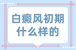 為什么會白殿風(fēng)-曬了一個月臉上有白斑怎么回事