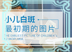 臉上為什么有一塊一塊白的(原因是什么)