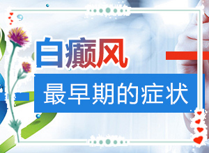 白點癲風的圖[癥狀表現(xiàn)特點是什么]手腕手指白班
