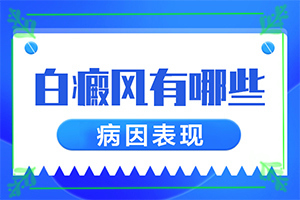哪家可以治白癲[什么方法治療]白癲治療費(fèi)用是多少