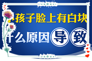 白癩風(fēng)是不是治不好-[教你判斷]怎樣控制白斑不擴散