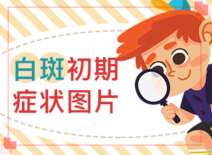 嬰兒出濕疹后臉上長了好多白斑,什么因素能導(dǎo)致(白斑病發(fā)的原因)