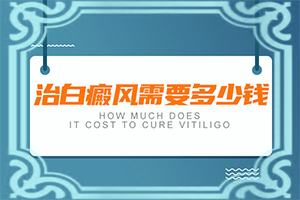 早期白癩風是小白點嗎[幾個基本表現(xiàn)]白點癲風和白斑的區(qū)別