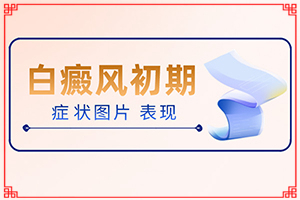 治白癜風(fēng)醫(yī)院哪家比較好,怎么辦(該如何)