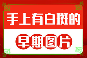 白殿斑早期圖片[不同時期的癥狀]女人身上有白癜風(fēng)咋辦