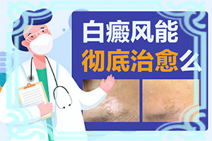 白瘋癲是怎么產(chǎn)生的-嬰幼兒胳膊上有白斑怎么回事。