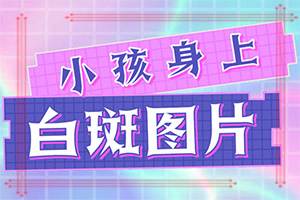 白癜風初期是什么樣的,癥狀有哪些方面的表現(xiàn)(發(fā)生后是什么樣子的)