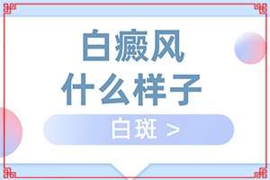 白癩風前期癥狀是什么,具體表現(xiàn)是哪些(如何知道白斑是否為白癜風)