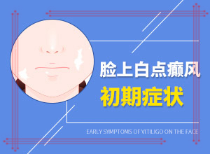 面上長白班什么原因,發(fā)病的時(shí)候有什么癥狀(應(yīng)該怎么護(hù)理)