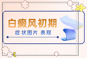 白癲風(fēng)早期表現(xiàn),具體表現(xiàn)是哪些(該如何診斷呢)