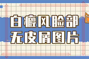 白瘋巔有什么癥狀表現(xiàn),得了會有什么癥狀呢(發(fā)作有什么癥狀)