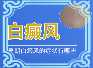 2歲寶寶臉上有白斑，膚色不均勻涂什么藥（為什么會好治）