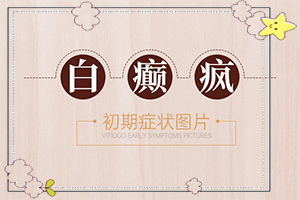 嘴唇有白斑是什么原因,主要表現(xiàn)是什么(是怎么回事)