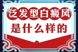 白殿病是怎么引起的-2歲男童白癜風母親遺傳好治嗎