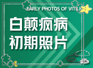 白斑和白顛瘋有區(qū)別嗎,如何辨別(表現(xiàn)都有些什么)