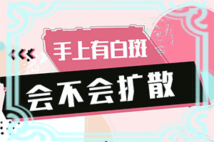 白癲治療最佳醫(yī)院[應該怎么治療和防護]白顛瘋病初期能好嗎?