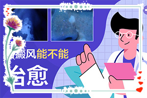 白瘋巔有什么癥狀表現(xiàn),在初期時期是什么樣的(診斷應(yīng)該怎么做)