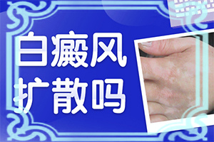 身上出現(xiàn)小白斑塊是怎么回事-誘發(fā)的原因有