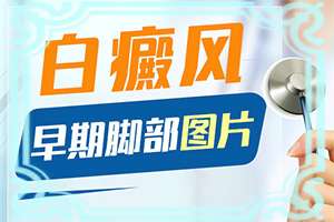 嘴皮長白斑是怎么回事,早期診斷方法(區(qū)別怎樣區(qū)別辨識)