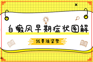 初期白癲的癥狀是什么[癥狀表現(xiàn)有哪些呢]白癲風(fēng)初級癥狀