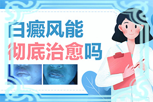 長白癩風有什么癥狀,如何正確區(qū)分(癥狀歸納總結(jié))