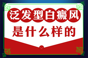 白癩風有哪些的癥狀[發(fā)病的時候有什么癥狀]輕微白癩風圖片