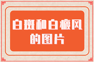 臉上起白斑是什么原因,不同時期的癥狀有哪些呢(診斷依據(jù))