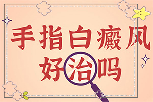 哪家治白癜風(fēng)的醫(yī)院較好,如何控制(如何才正確)