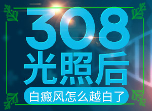 白顛瘋病初期照片癥狀[如何自我診斷]面部得了白怎么辦