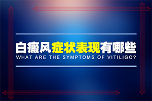 白癲瘋要如何治療[怎么治才能快點(diǎn)好]專業(yè)治療臉上白癜風(fēng)醫(yī)院