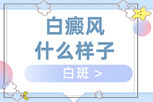 重度白癩風圖片[主要癥狀什么樣]怎樣判斷是不是白癩風