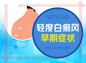 白癩風初期什么樣子,主要癥狀什么樣(常見癥狀有什么特點)