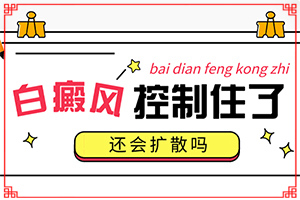 身上長了白斑是什么原因-發(fā)作原因是哪些