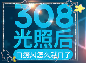 白癲瘋初期圖片特點[如何區(qū)分]白癩風有哪些的癥狀