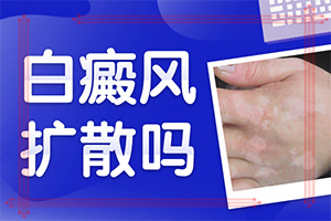 喝了補(bǔ)腎的藥胳膊上有白斑出現(xiàn),出現(xiàn)后該怎么辦(導(dǎo)致的因素有哪些)