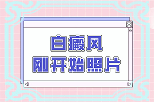 手指關(guān)節(jié)白斑是怎么回事[發(fā)病特點]皮膚有點白班什么情況