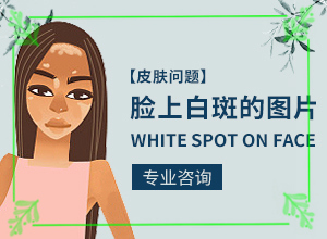 [效果好嗎治療手上白斑有效的方法