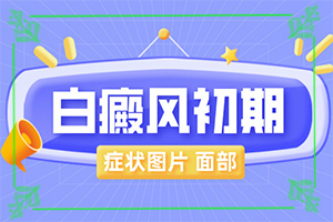 治療白癜風用中藥治療好嗎,效果不怎么辦(哪些方面治療效果好)