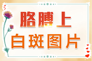 怎么白癲瘋是怎得上的,哪些因素導致(誘發(fā)的原因有)