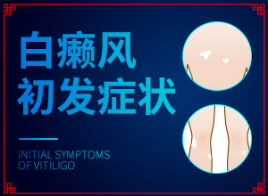 白癜風(fēng)出現(xiàn)后該怎么辦-小孩入秋臉上長白斑是怎么回事