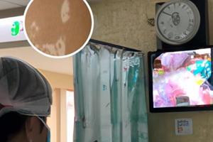 小孩的臉上長(zhǎng)白斑怎么回事