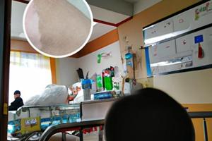 體內(nèi)黑色素過(guò)多怎么去除